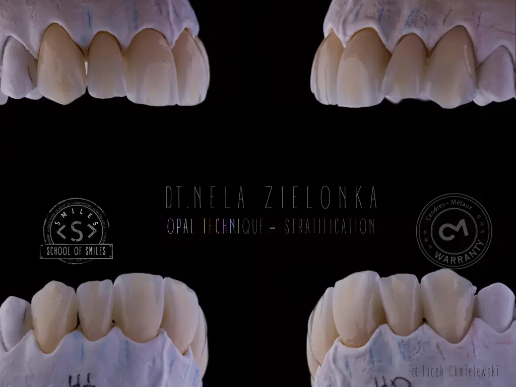 Estetyczne uzupełnienia protetyczne wykonane techniką Opal Technique Stratification – realistyczna warstwowa odbudowa zębów przednich na modelu gipsowym, projekt autorstwa technika dentystycznego Neli Zielonki w School of Smiles.