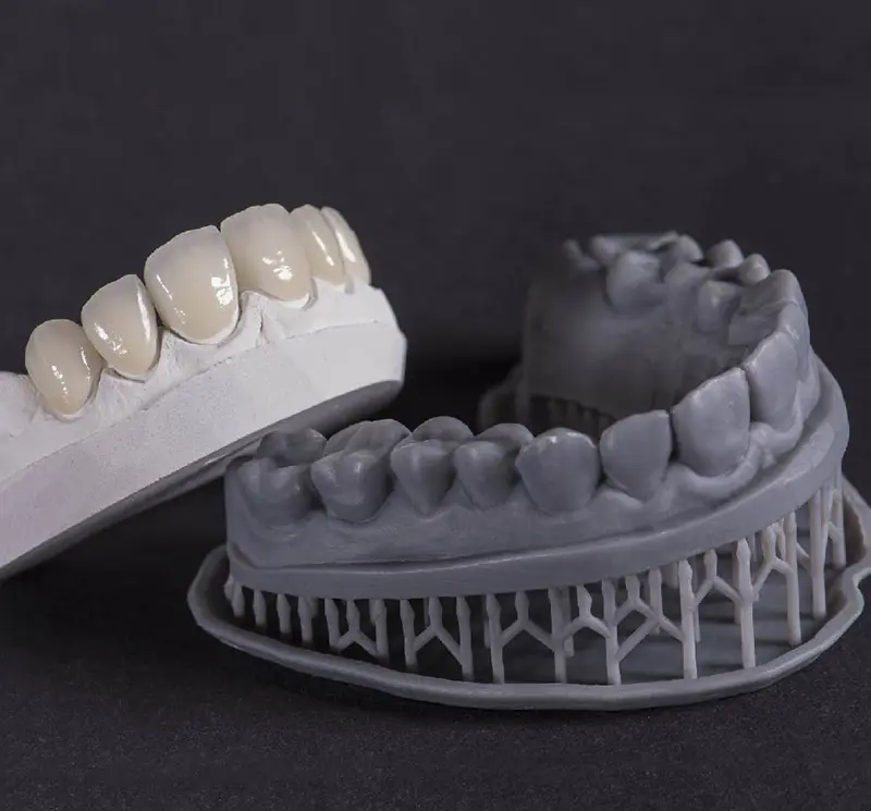 Porównanie dwóch modeli zębów: gipsowego z gotowymi koronami oraz szarego modelu wydrukowanego w technologii 3D z widocznymi podporami.