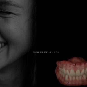 GUMI N DENTURES