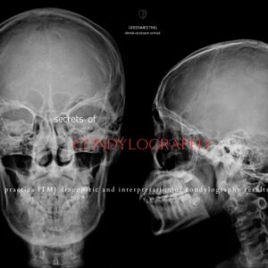 Szkolenie z kondylografii — od podstaw do praktyki klinicznej
