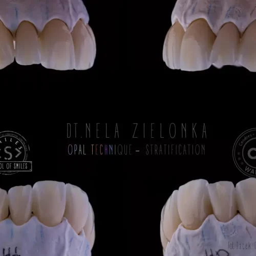 Estetyczne uzupełnienia protetyczne wykonane techniką Opal Technique Stratification – realistyczna warstwowa odbudowa zębów przednich na modelu gipsowym, projekt autorstwa technika dentystycznego Neli Zielonki w School of Smiles.